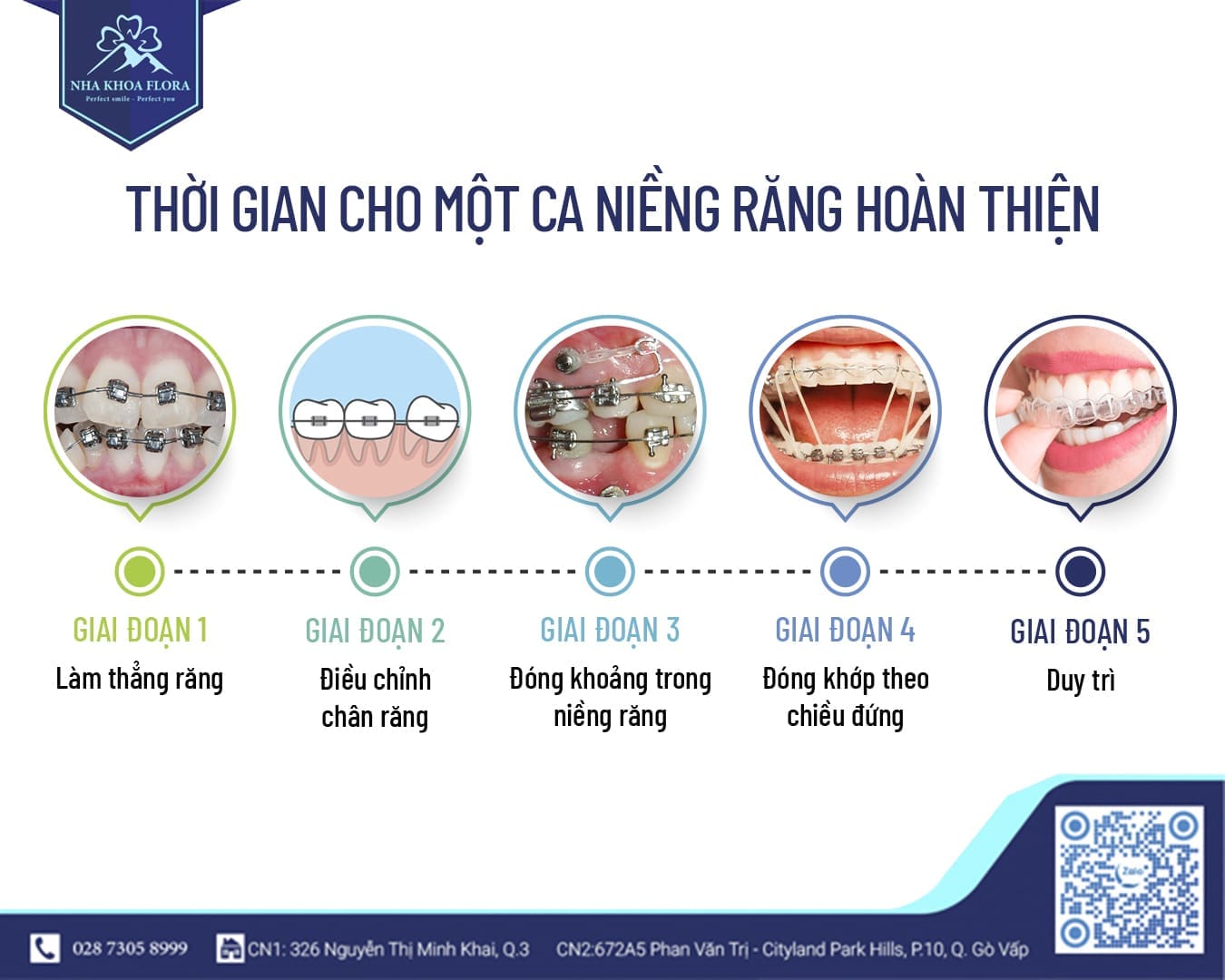 Các giai đoạn trong quy trình niềng răng mắc cài