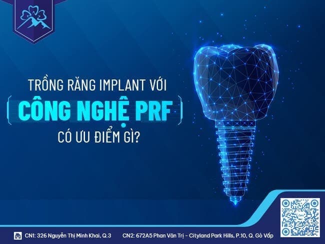 Một số ưu điểm khi đưa công nghệ PRF vào quy trình trồng răng Implant