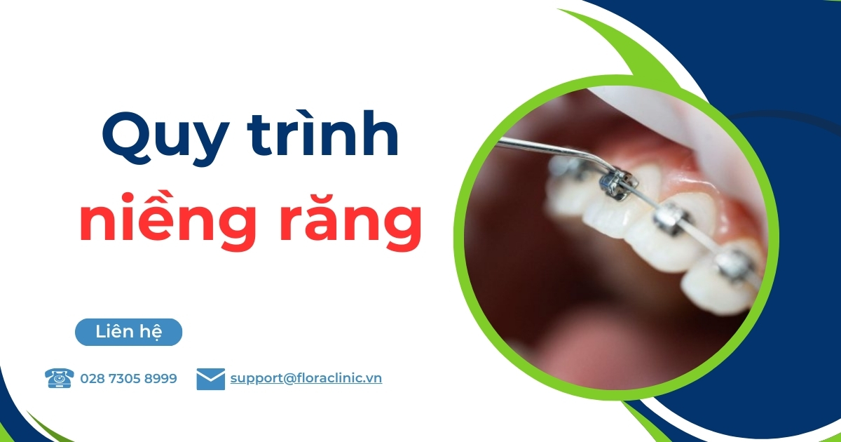 Quy trình niềng răng chuẩn Y khoa diễn ra như thế nào?