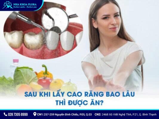 lưu ý sau khi cạo vôi răng - ảnh 4 lưu ý sau khi cạo vôi răng - ảnh 4