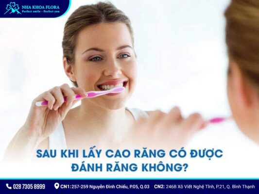 lưu ý sau khi cạo vôi răng - ảnh 5 lưu ý sau khi cạo vôi răng - ảnh 5