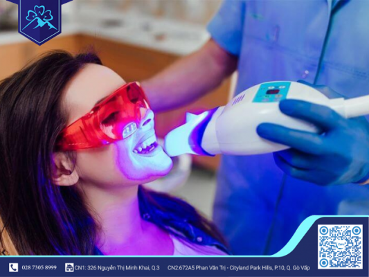 BẠN CÓ BIẾT NÊN TẨY TRẮNG RĂNG BAO NHIÊU LẦN MỘT NĂM? 1