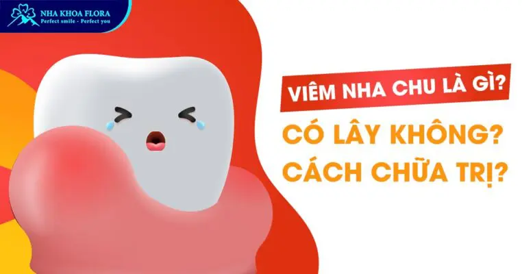 Viêm nha chu - Bệnh lý răng miệng không thể chủ quan 1
