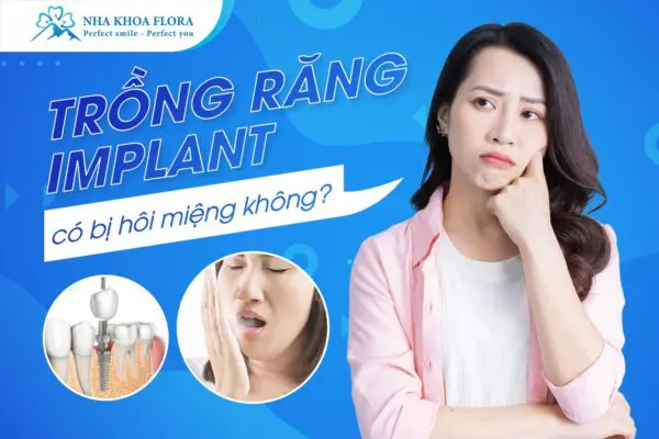 Trồng Răng Implant Có Bị Hôi Miệng Không? 1