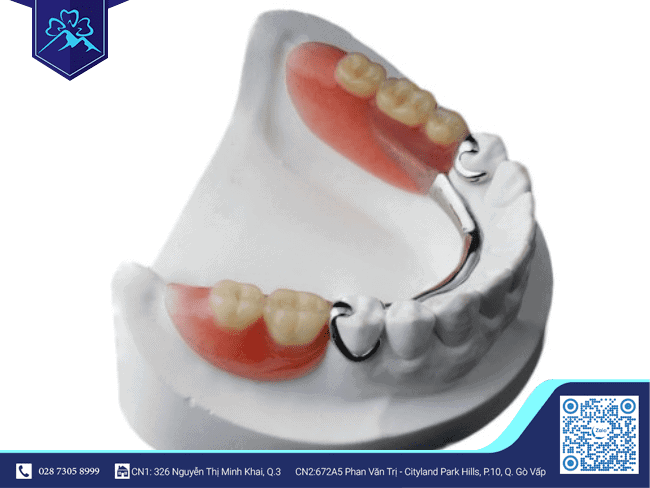 Phương pháp răng giả tháo lắp khắc phục tình trạng gãy 3 răng trong cùng