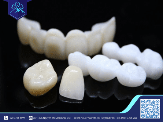 THAY MỚI RĂNG SỨ TRÊN IMPLANT ĐƯỢC KHÔNG? 1