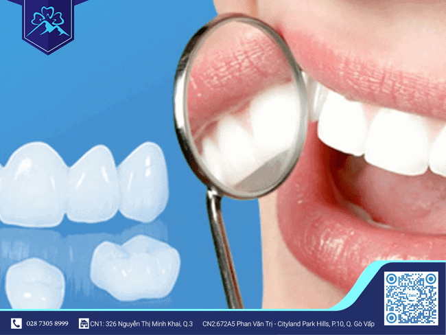 Lưu ý khi bọc răng sứ - Bọc răng sứ cần kiêng hoạt động nào??