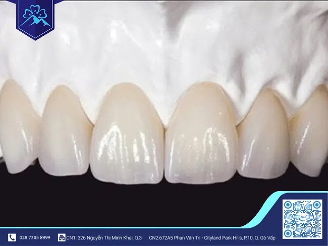 Răng sứ Zirconia