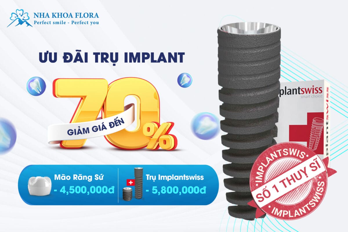Siêu ưu đãi ngày hè dành cho trồng răng Implant - lên đến 70%