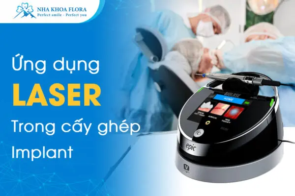 Ứng Dụng Laser Trong Cấy Ghép Implant 7