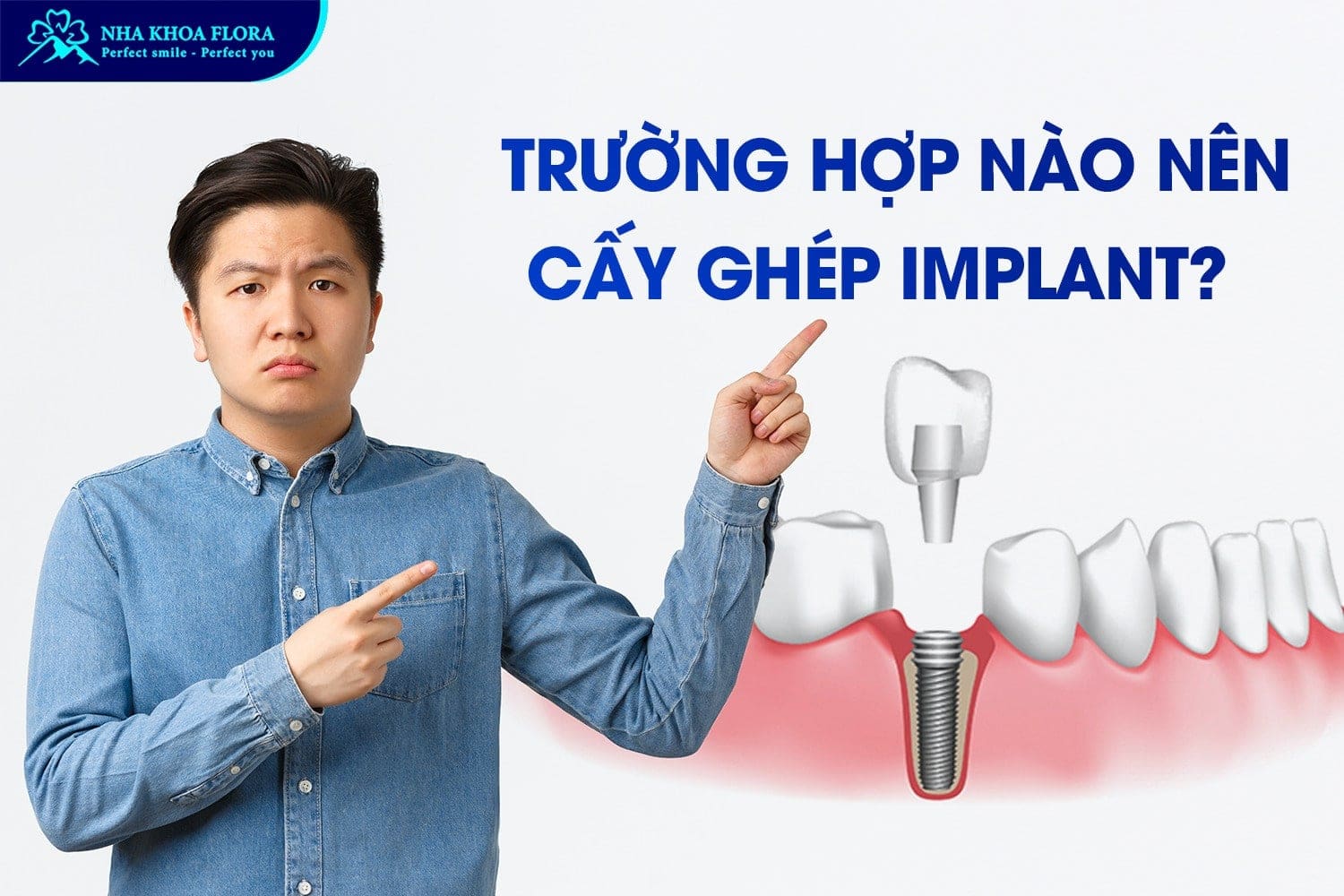 Bỏ Túi 9 Kinh Nghiệm Trồng Răng Implant Hiệu Quả - ảnh 1 Bỏ Túi 9 Kinh Nghiệm Trồng Răng Implant Hiệu Quả - ảnh 1