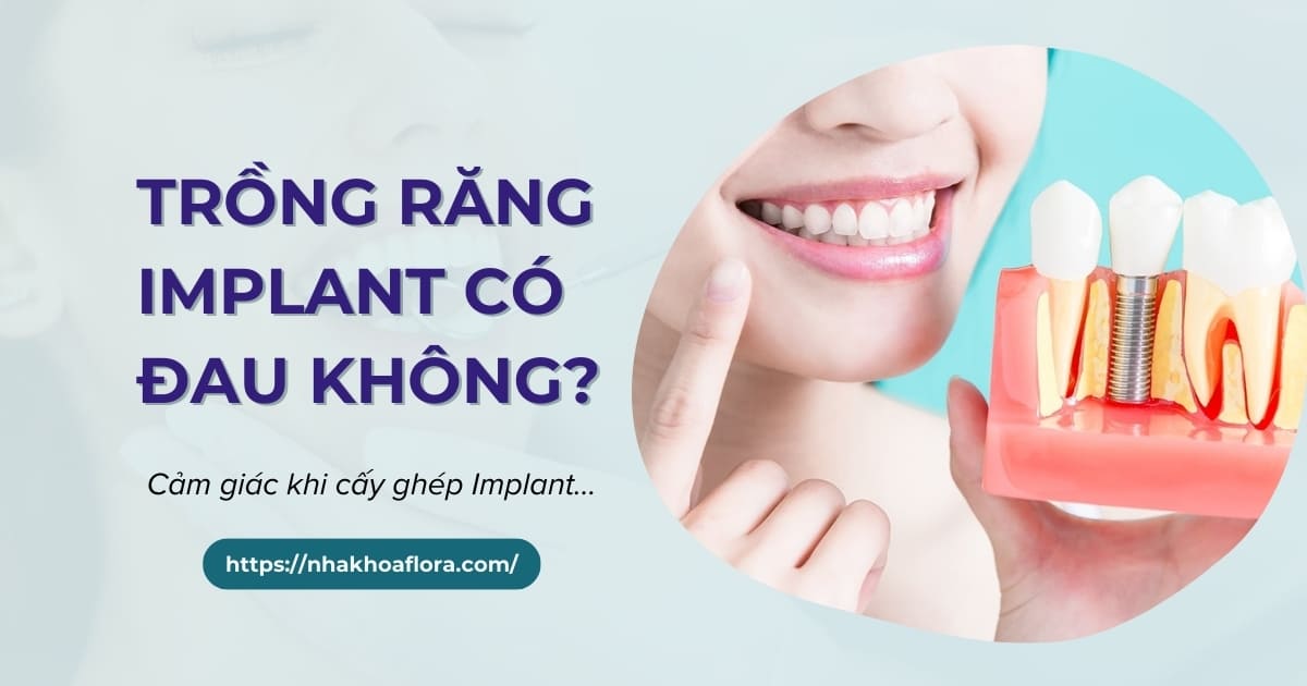 Trồng răng Implant có đau không? Cảm giác như thế nào?