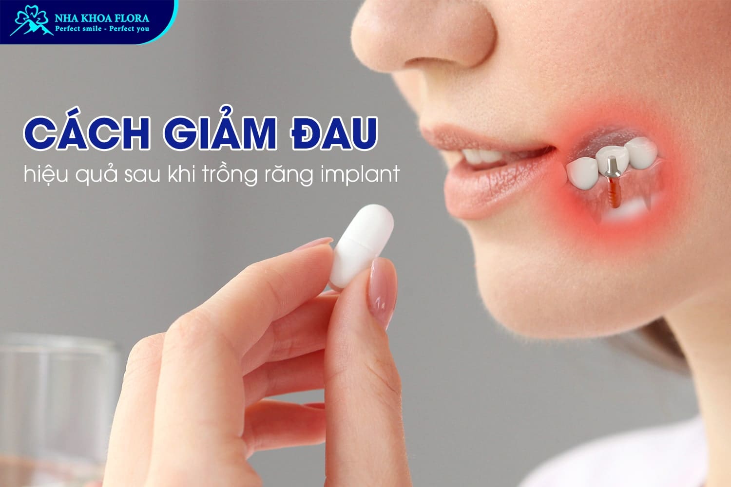 Hỏi Đáp: Trồng Răng Implant Có Đau Không? - ảnh 4 Hỏi Đáp: Trồng Răng Implant Có Đau Không? - ảnh 4