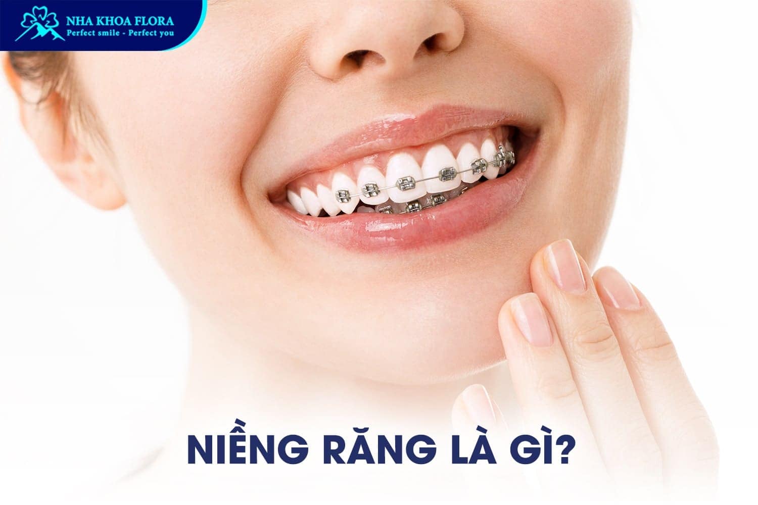 Trồng Răng Implant Có Niềng Răng Được Không? - ảnh 2
