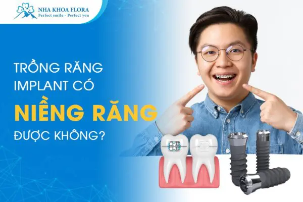 Trồng Răng Implant Có Niềng Răng Được Không? 5