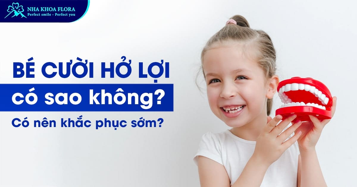 bé cười hở lợi