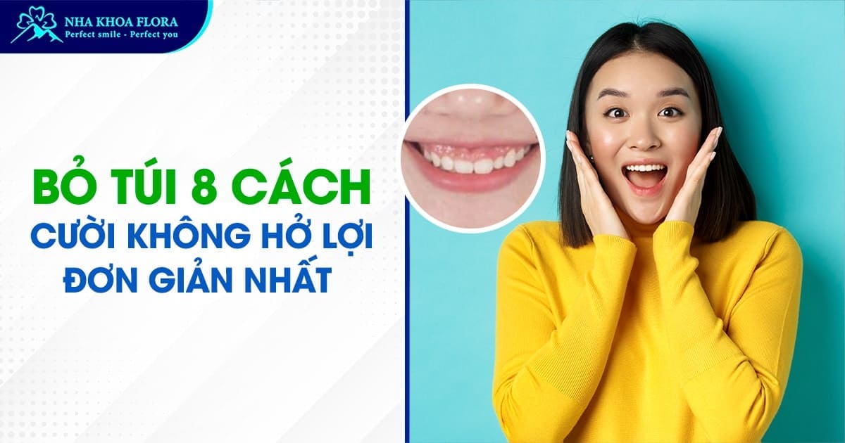 cách cười không hở lợi