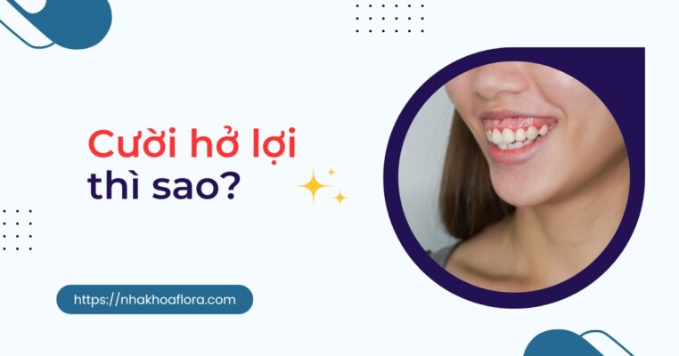 cười hở lợi thì sao