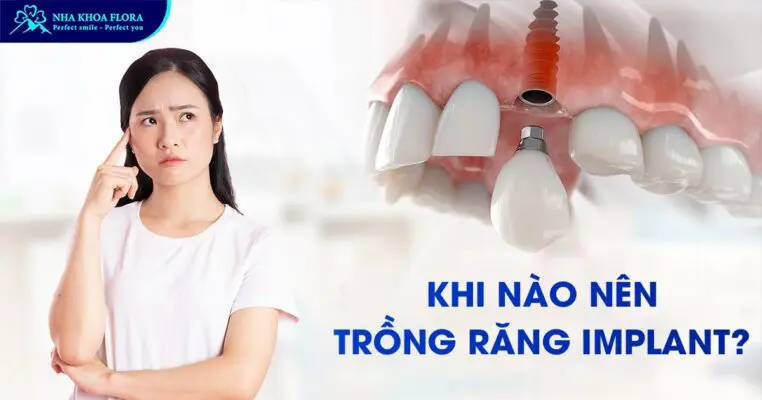 Giải Đáp Khi Nào Nên Trồng Răng Implant? 5