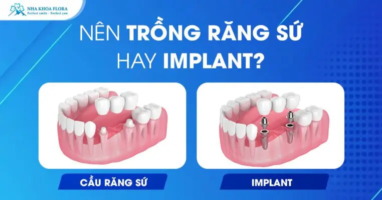 Nên Trồng Răng Sứ Hay Implant? Lựa Chọn Nào Tốt Nhất? 7