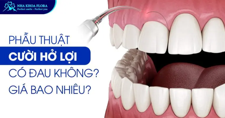 Phẫu Thuật Cười Hở Lợi Có Đau Không? Giá Bao Nhiêu? 3