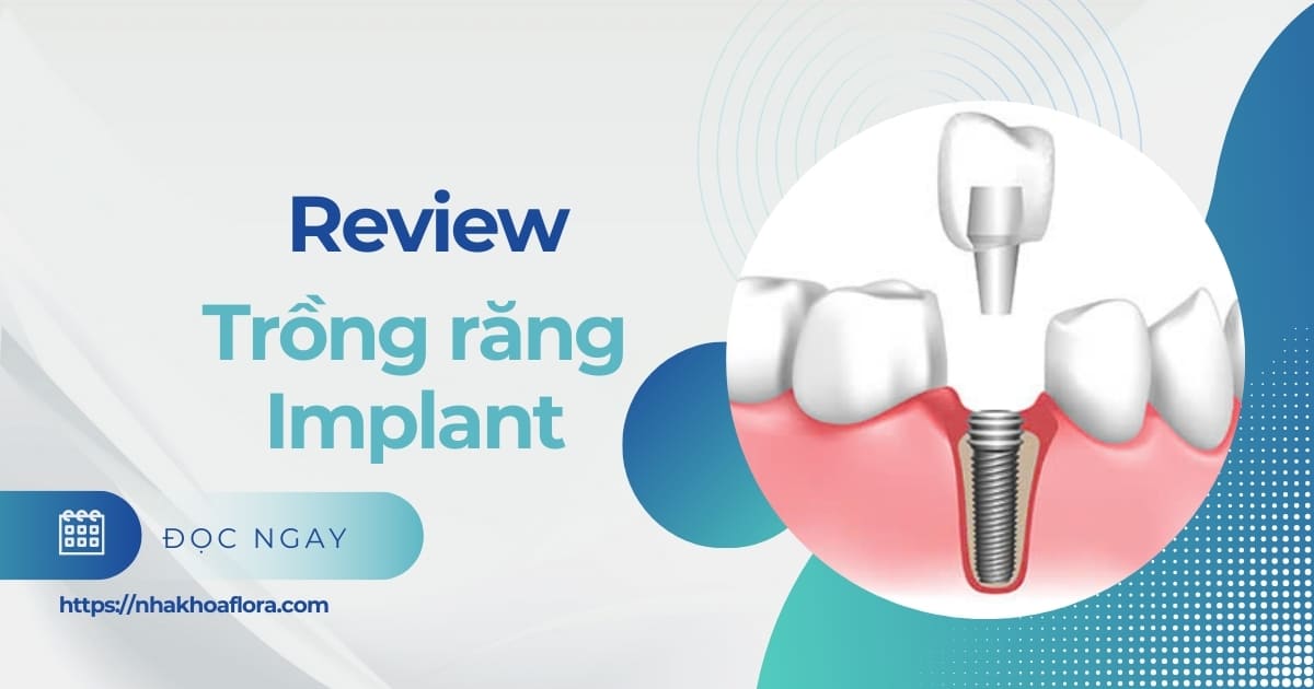 Review trồng răng Implant từ khách hàng tại Nha khoa Flora