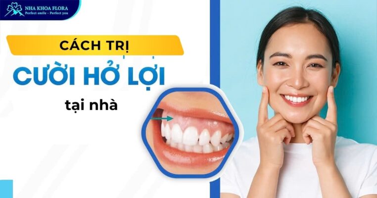 trị cười hở lợi tại nhà