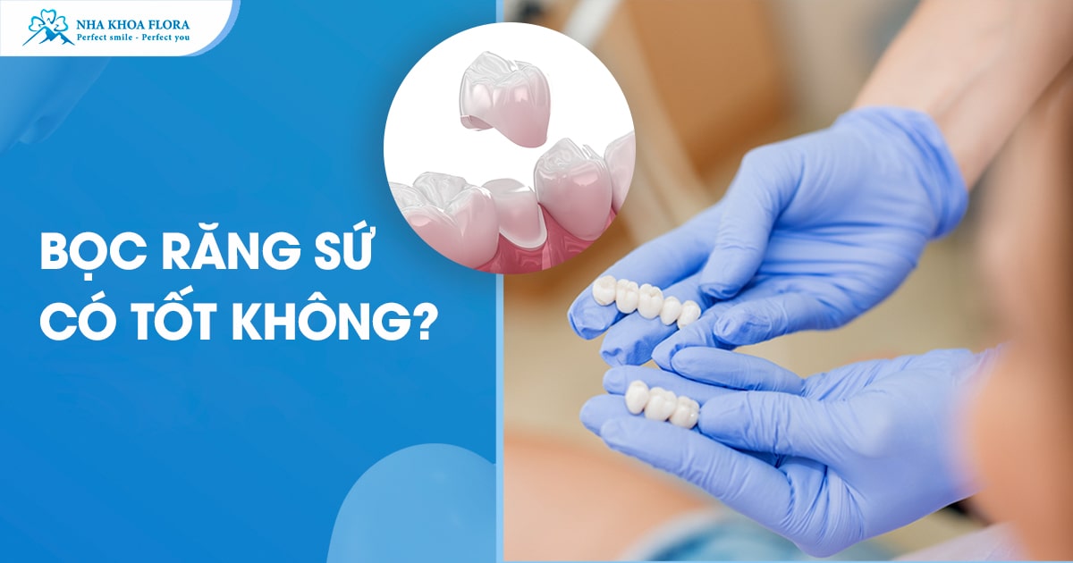 Bọc răng sứ có tốt không? Tư vấn có nên làm răng sứ không?