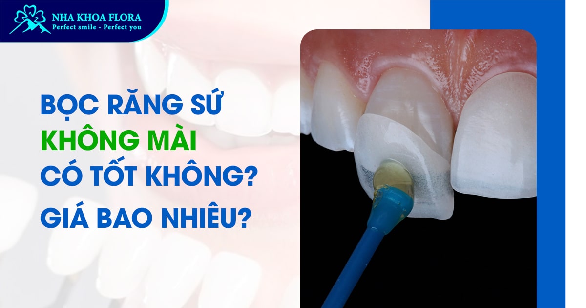 Bọc răng sứ không mài có tốt không? Giá bao nhiêu tiền?