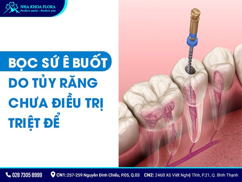 làm răng sứ sau bao lâu thì hết ê buốt