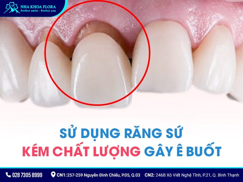 làm răng sứ sau bao lâu thì hết ê buốt