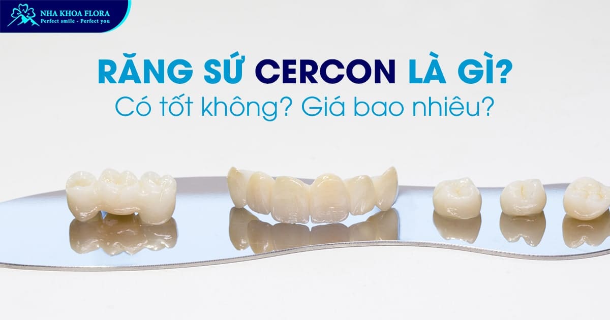 răng sứ Cercon