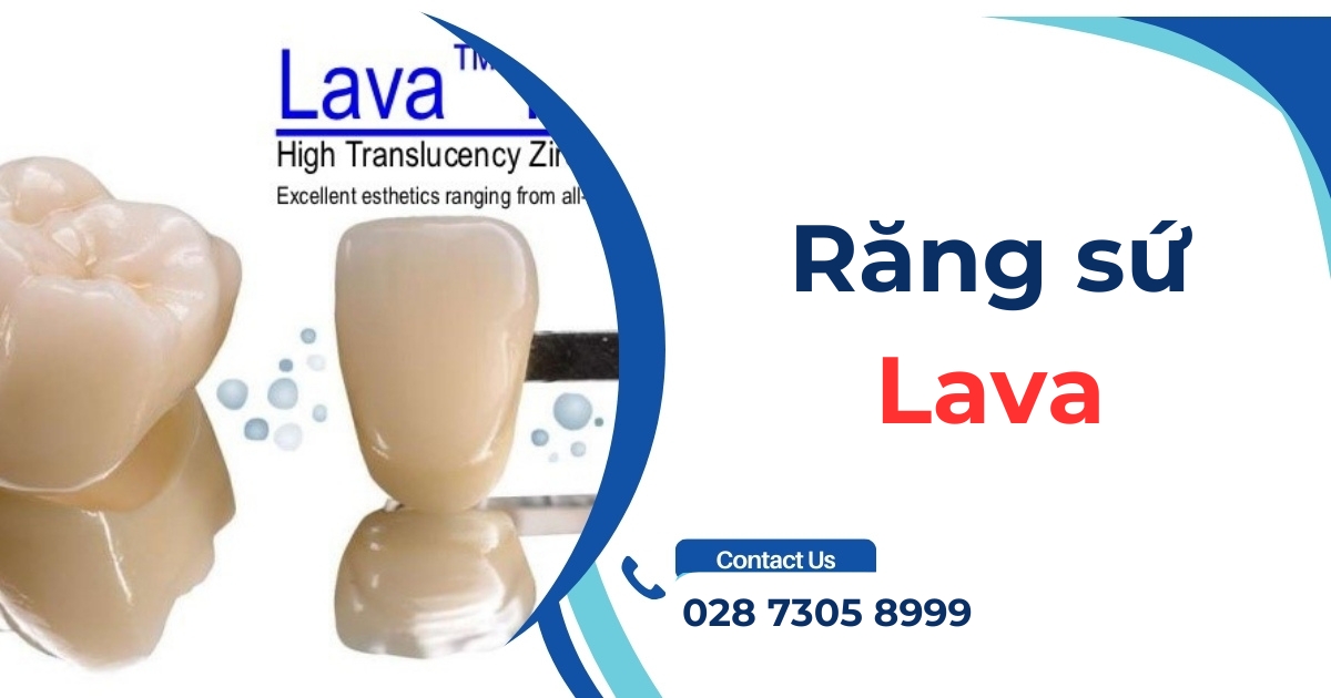 Răng sứ Lava là gì? Có nên lựa chọn? Giá bao nhiêu tiền?