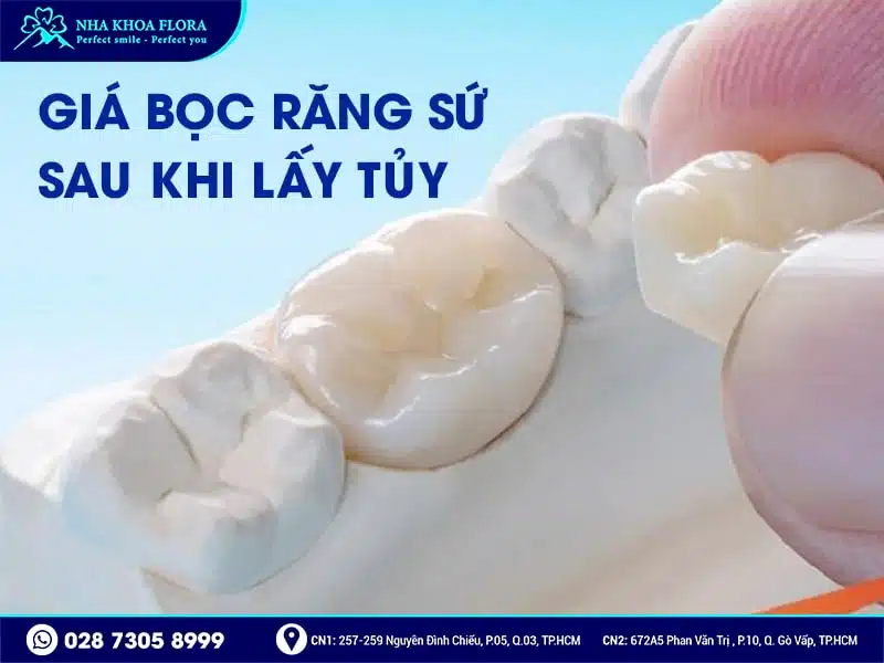 Bọc răng sứ sau khi lấy tủy - ảnh 4 Bọc răng sứ sau khi lấy tủy - ảnh 4