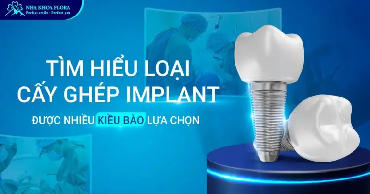 Tìm hiểu loại trụ Implant được nhiều Kiều Bào lựa chọn 8