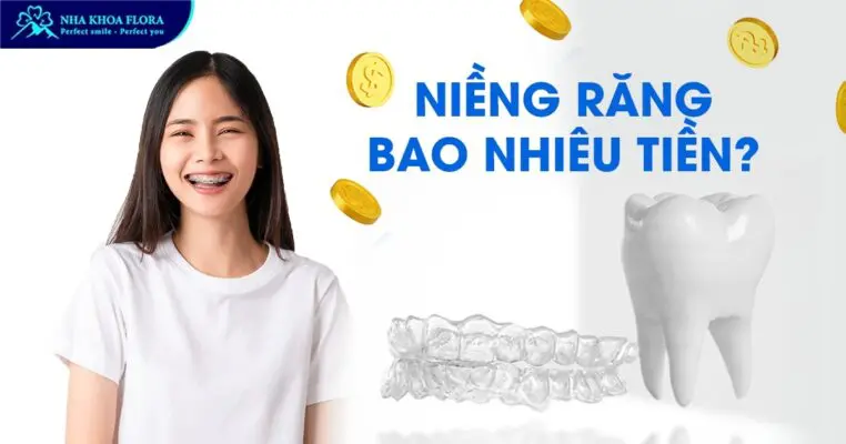 Niềng răng bao nhiêu tiền? Bảng giá chỉnh nha 2024 1