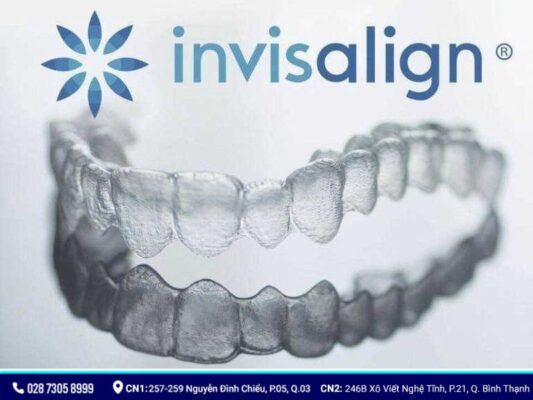 niềng răng trong suốt - ảnh 3 niềng răng trong suốt - ảnh 3