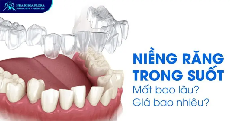 niềng răng trong suốt