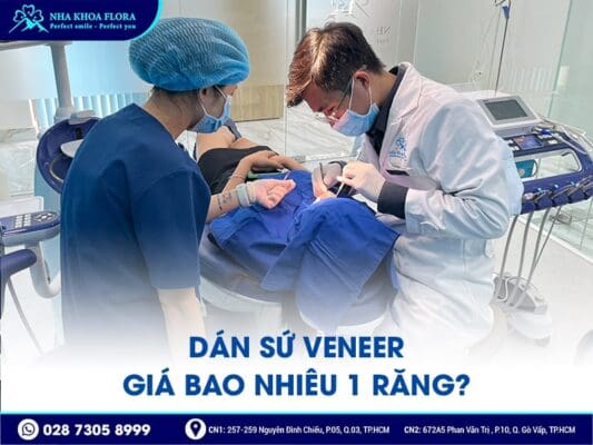 dán sứ Veneer - ảnh 4 dán sứ Veneer - ảnh 4