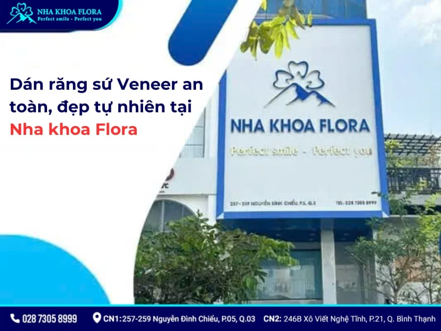 dán sứ veneer giá bao nhiêu