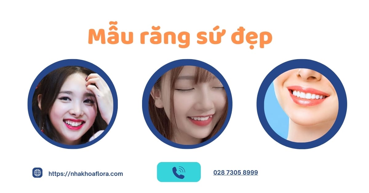 Bỏ túi 9 mẫu răng sứ đẹp nhất và phù hợp với từng khuôn mặt