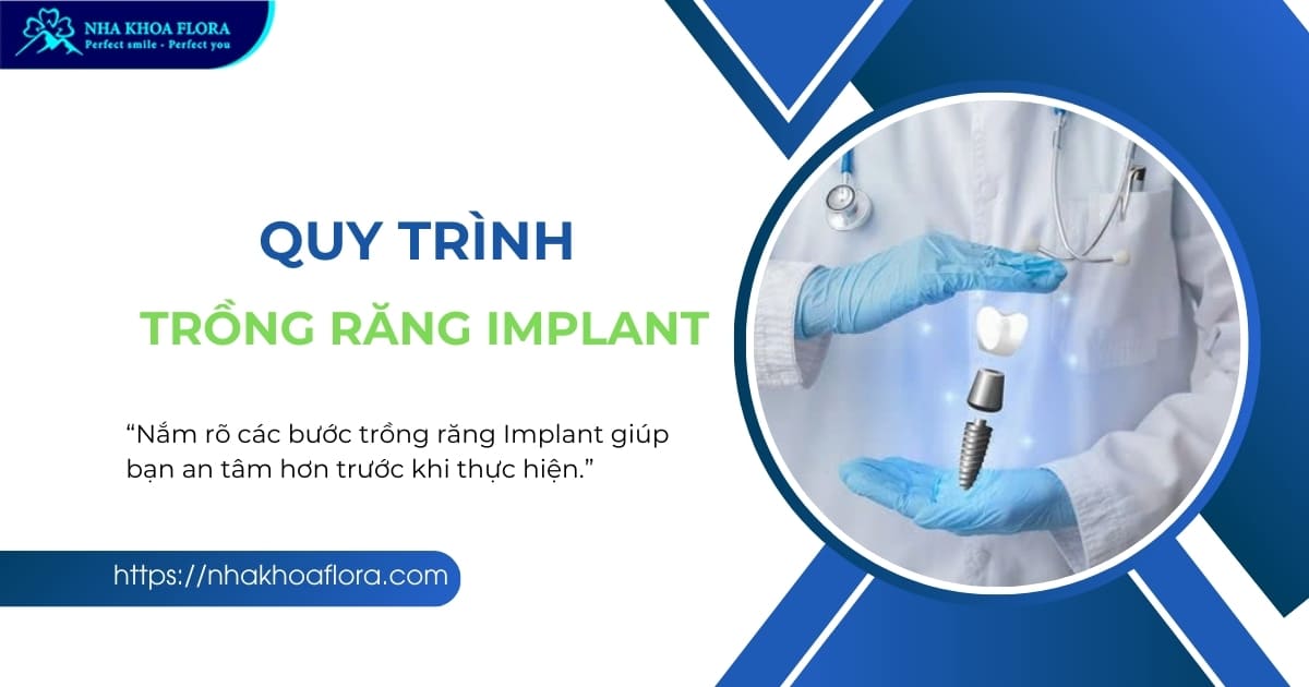 Quy trình trồng răng Implant tiêu chuẩn Quốc tế tại Flora