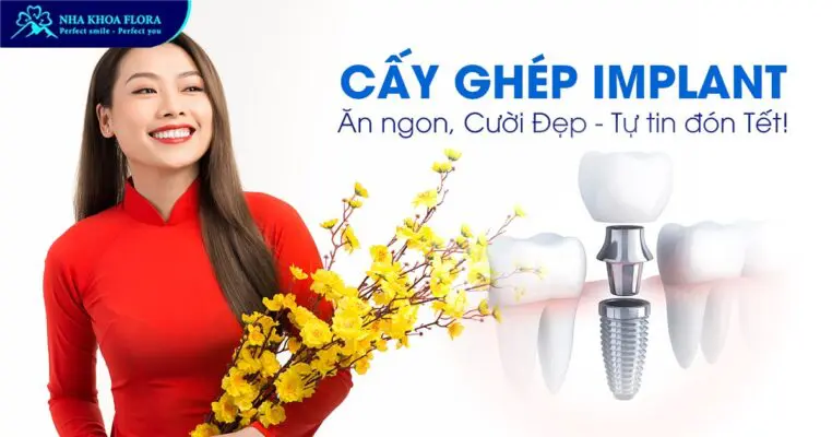 Cấy ghép Implant: Ăn ngon, Cười Đẹp – Tự tin đón Tết! 2