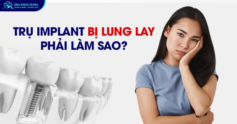 Trụ Implant Bị Lung Lay Phải Làm Sao? 1