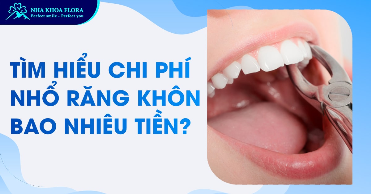Chi phí nhổ răng khôn bao nhiêu? [Cập nhật mới nhất 2025]