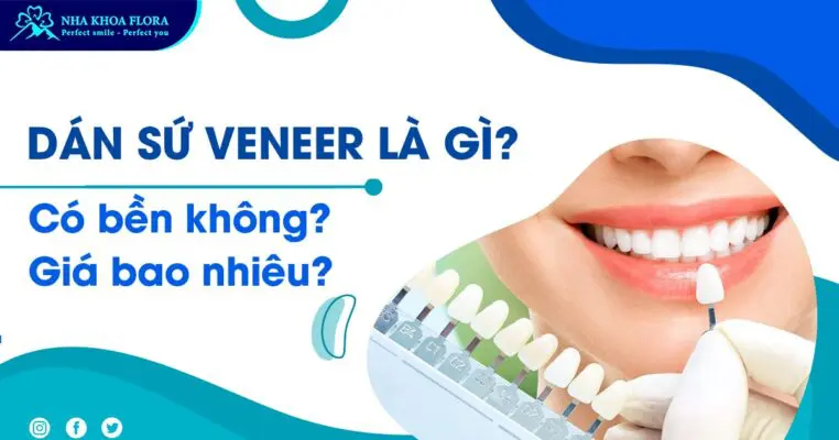 Dán sứ Veneer Là Gì? Có Bền Không? Giá Bao Nhiêu? 2