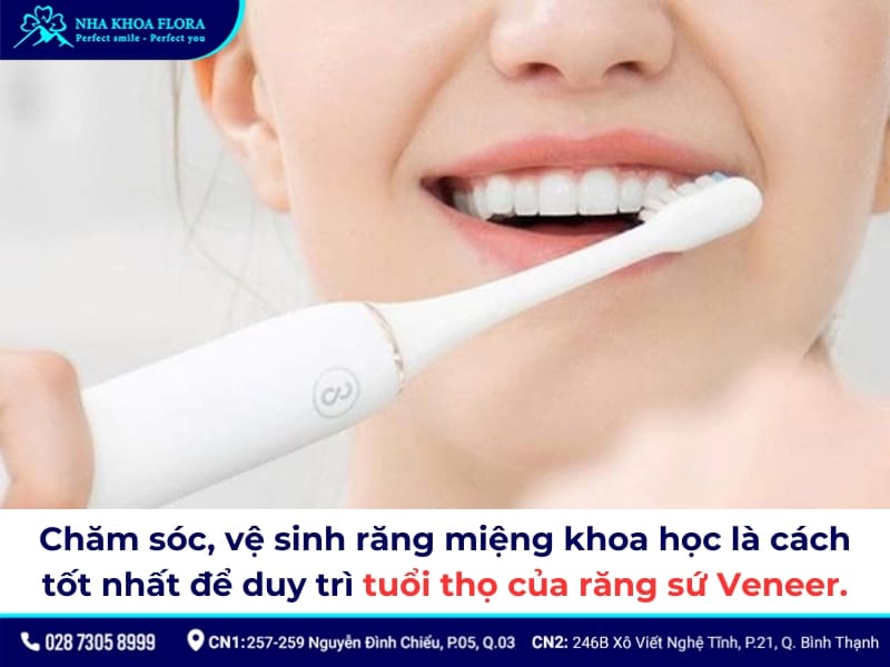 dán sứ veneer có bền không