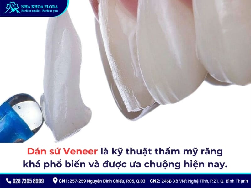 dán sứ veneer có bền không