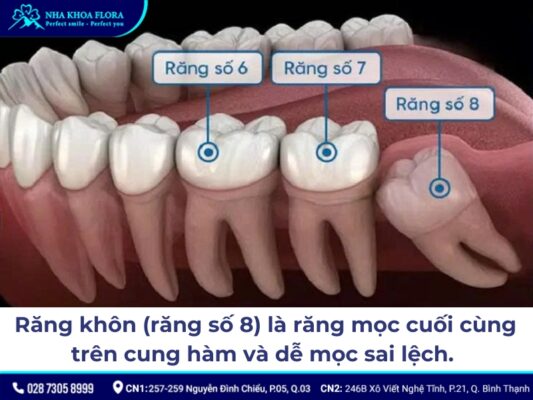 nhổ răng khôn có nguy hiểm không - ảnh 1 nhổ răng khôn có nguy hiểm không - ảnh 1