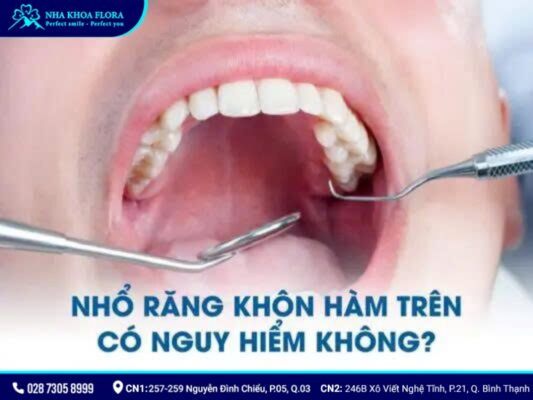 nhổ răng khôn có nguy hiểm không - ảnh 3 nhổ răng khôn có nguy hiểm không - ảnh 3
